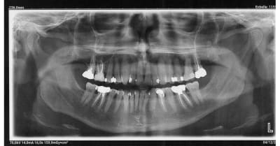 59i7iqjymj1dyh6xp4aasm483kh0 - Eugenol