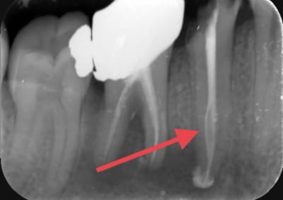 5c64e904 5f56 48ec a8dc 3c2e6036b936 ocppma - Eugenol