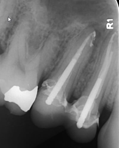 5   09102015 flgyp2 - Eugenol