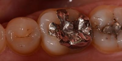 5 ans3 b5elmr - Eugenol