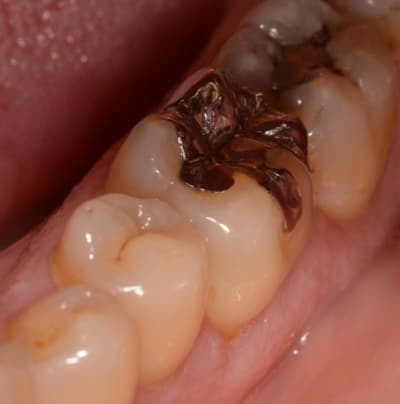 5 ans yqlqmx - Eugenol