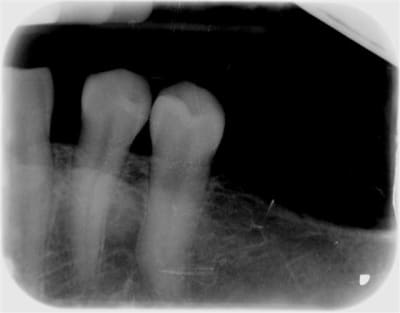 69 x 0000005d 3  small  pvoaat - Eugenol