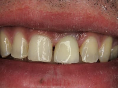 6993 73 qajnpc - Eugenol