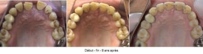 7406 9 ans  2   ecj11d - Eugenol