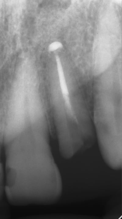 7554 2 bfi6tr - Eugenol