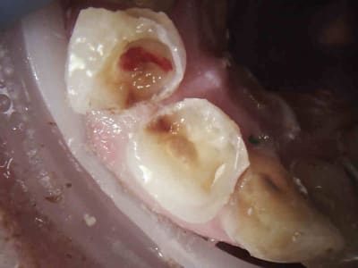 7 dpigl1 - Eugenol