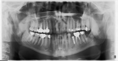 7mars2008 wk3uen - Eugenol