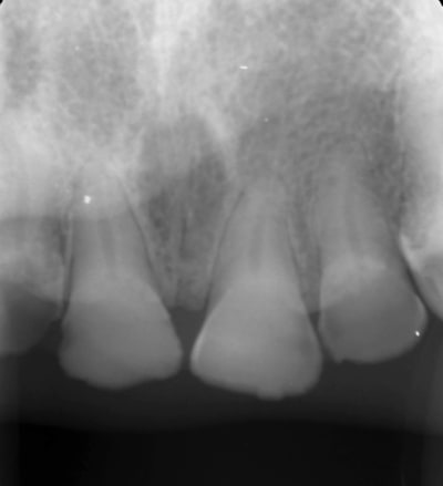 8af24b3d fd05 4021 a759 7a5e9e05a6a7 h5jlk1 - Eugenol