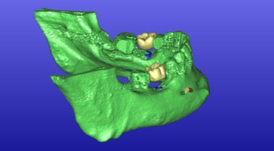 8mm   3d iuesah - Eugenol