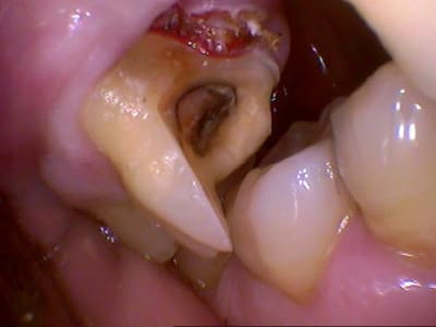 959 ayi2wi - Eugenol