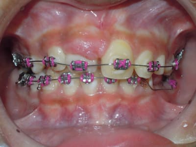 9 y30xhz - Eugenol