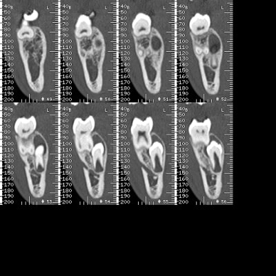 A16 d1nbl8 - Eugenol