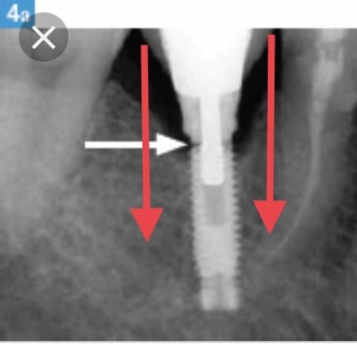 A2c1e4bb 7dc5 4f0b 96ac 6bd329534174 dregiy - Eugenol