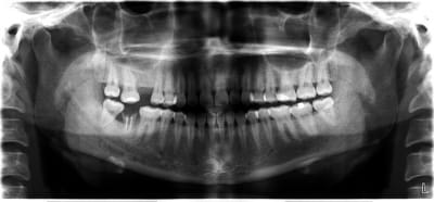 A4edit aoaib3 - Eugenol