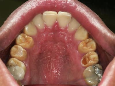 Adam  large  tollgh - Eugenol