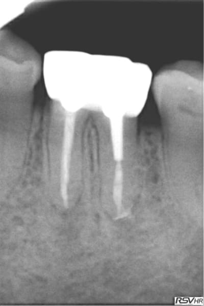 Al5 dovohh - Eugenol