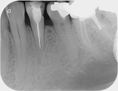 Alapex jean pierre 000 tblr9u - Eugenol