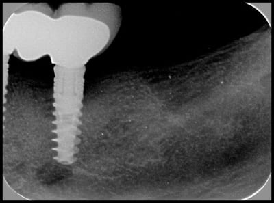 Am convertimage n4od5s - Eugenol