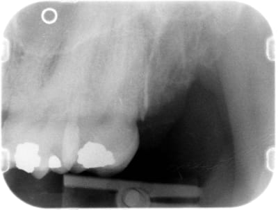 Aprèsyenamois u5u0iv - Eugenol