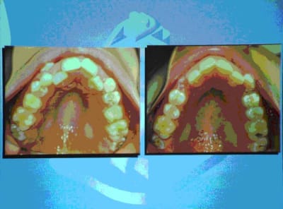 Arcades 1 o1i5fx - Eugenol