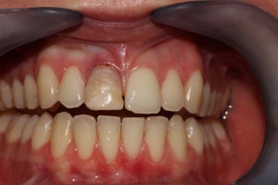 Avant1 dehb09 - Eugenol