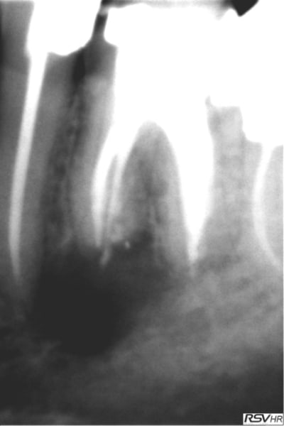 B3 d2qbte - Eugenol