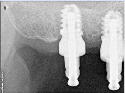 Baby 1 bsiaeo - Eugenol