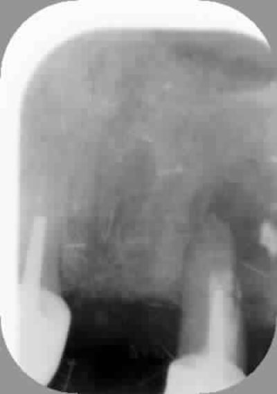 Biphos eub33o - Eugenol