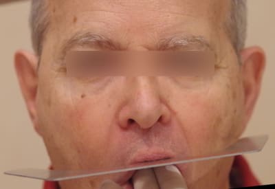 B face yjvtkh - Eugenol