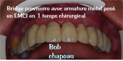 Bob chapeau latk9w - Eugenol