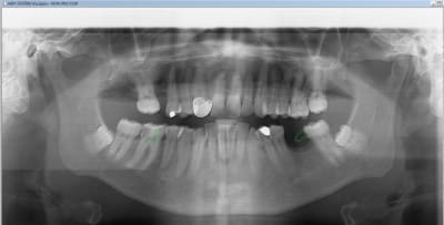 Bridge made in marocco 3 nkqaqc - Eugenol