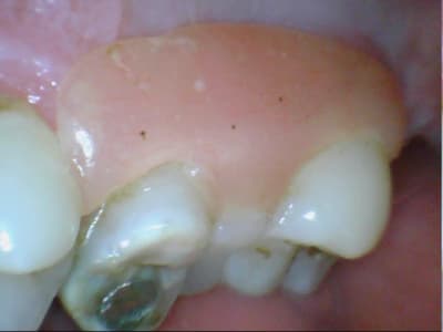 Bridge made in marocco y6s47d - Eugenol
