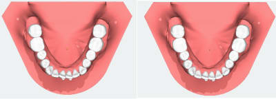 Caaa dcmjb3 - Eugenol