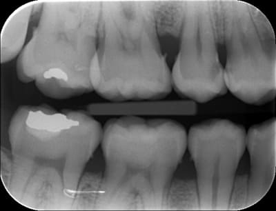 Caval t9cjzv - Eugenol