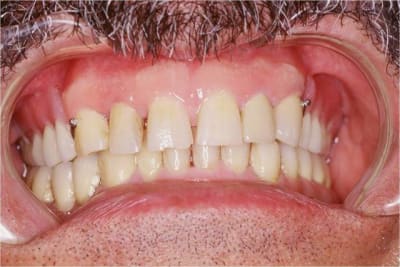 Cr esthetique 1 d0leas - Eugenol