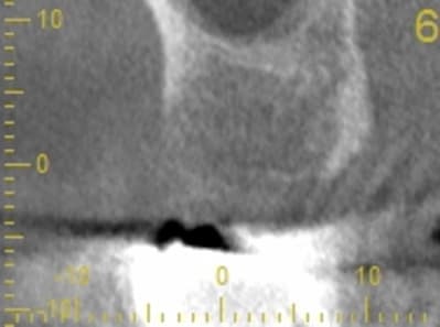 Cs 20131209 0838 6 xhtdn7 - Eugenol