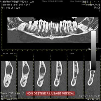 Ct1 olvmyv - Eugenol