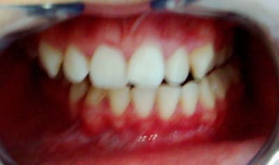 C dsci0019 tngwym - Eugenol