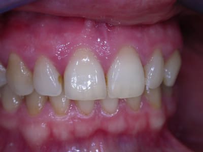 C dscn1687 iq4lzl - Eugenol