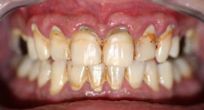 C img 0705 ewkven - Eugenol
