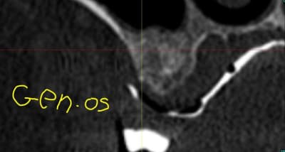 Capture1 l4rbab - Eugenol