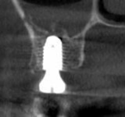 Capture1 wqdn0f - Eugenol