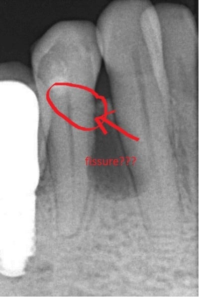 Capture2 f6jurr - Eugenol