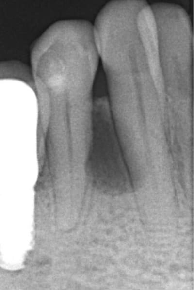 Capture2 kray4z - Eugenol