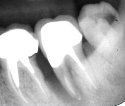 Capture2 puuiyv - Eugenol