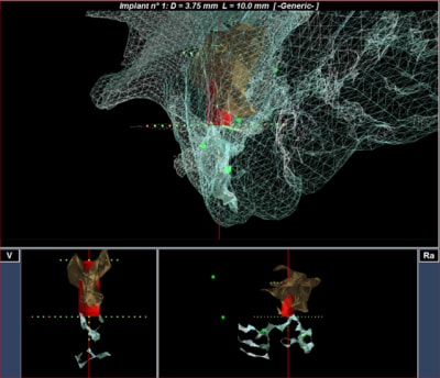 Capture3 wa2uw2 - Eugenol