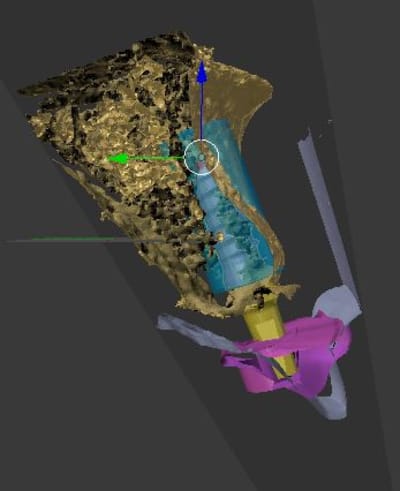 Capture bmyigc - Eugenol
