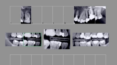Capture d écran 2017 01 06 14.17 - Eugenol