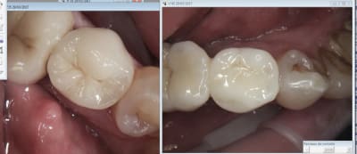 Capture d écran 2017 03 29 19.32 - Eugenol