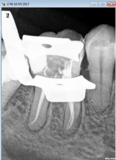 Capture d écran 2017 05 24 11.12 - Eugenol